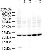 Western blot - Anti-Mad2L1 antibody [17D10] (AB10691)