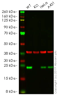 Western blot - Anti-Mad2L1 antibody [17D10] (AB10691)