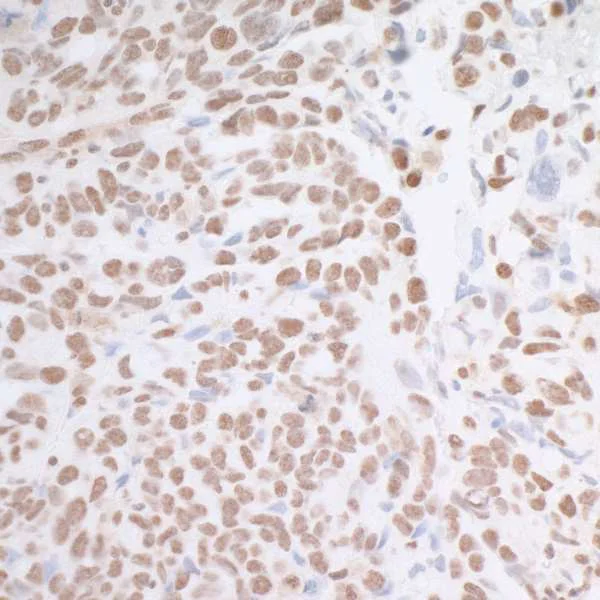 Immunohistochemistry (Formalin/PFA-fixed paraffin-embedded sections) - Anti-Mad2L1 antibody (AB70383)