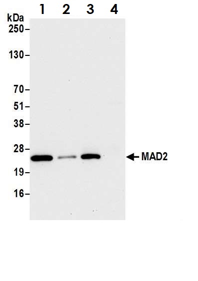 Immunoprecipitation - Anti-Mad2L1 antibody (AB70383)