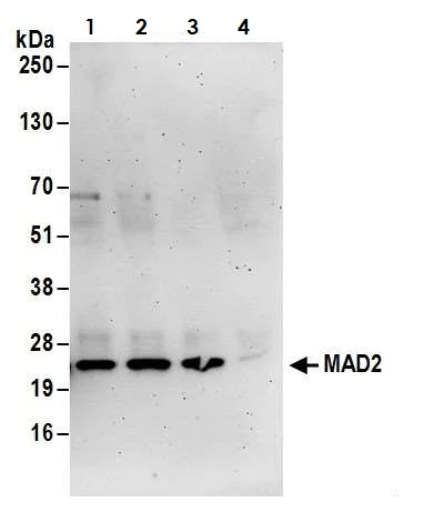 Immunoprecipitation - Anti-Mad2L1 antibody (AB70385)