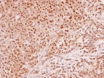 Immunohistochemistry (Formalin/PFA-fixed paraffin-embedded sections) - Anti-Mad2L1 antibody (AB97777)