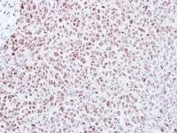 Immunohistochemistry (Formalin/PFA-fixed paraffin-embedded sections) - Anti-Mad2L1 antibody (AB97777), expandable thumbnail