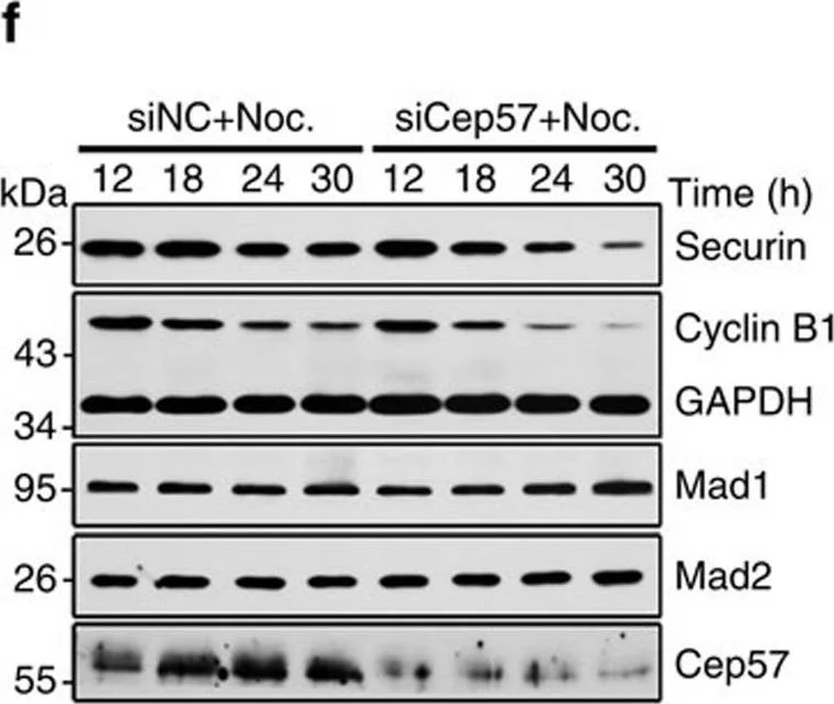 Western blot - Anti-Mad2L1 antibody (AB97777)