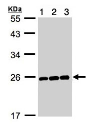 Western blot - Anti-Mad2L1 antibody (AB97777), expandable thumbnail