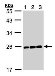 Western blot - Anti-Mad2L1 antibody (AB97777)