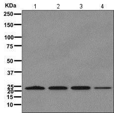 Western blot - Anti-Mad2L1 antibody [EPR9852] (AB171084)