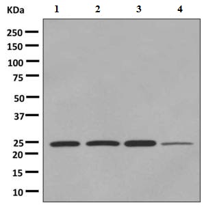 Western blot - Anti-Mad2L1 antibody [EPR9853(B)] (AB150371), expandable thumbnail