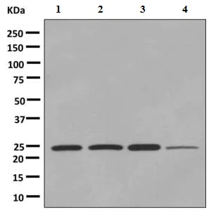 Western blot - Anti-Mad2L1 antibody [EPR9853(B)] (AB150371)