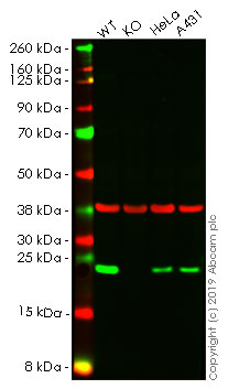 Western blot - Anti-Mad2L1 antibody [EPR9853(B)] (AB150371), expandable thumbnail