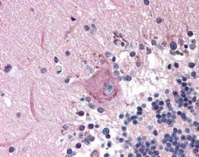 Immunohistochemistry (Formalin/PFA-fixed paraffin-embedded sections) - Anti-Mad2L2/REV7 antibody (AB115622)