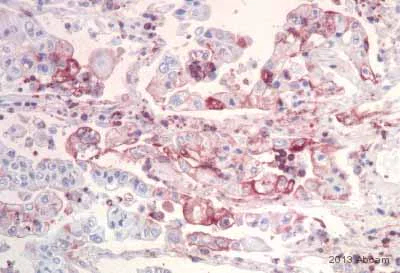 Immunohistochemistry (Formalin/PFA-fixed paraffin-embedded sections) - Anti-Mad2L2/REV7 antibody (AB115622)