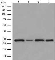 Western blot - Anti-Mad2L2/REV7 antibody [EPR13657] (AB180579)