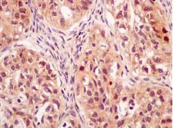 Immunohistochemistry (Formalin/PFA-fixed paraffin-embedded sections) - Anti-Mad2L2/REV7 antibody [EPR13657] - BSA and Azide free (AB232620)