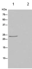 Immunoprecipitation - Anti-Mad2L2/REV7 antibody [EPR13657] - BSA and Azide free (AB232620)