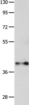 Western blot - Anti-MAdCAM1 antibody (AB198277)