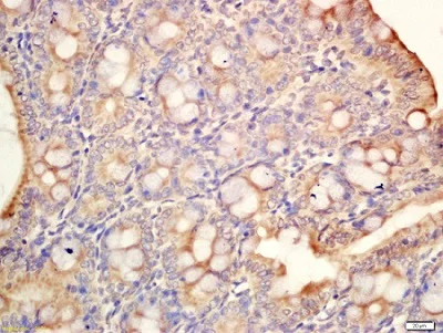 Immunohistochemistry (Formalin/PFA-fixed paraffin-embedded sections) - Anti-MAdCAM1 antibody (AB214198)