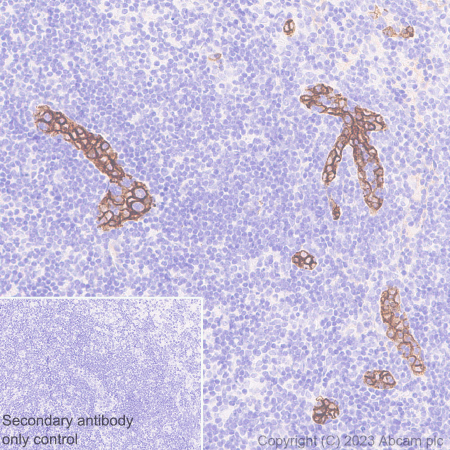 Immunohistochemistry (Formalin/PFA-fixed paraffin-embedded sections) - Anti-MAdCAM1 antibody [EPR27223-58] (ab309487), expandable thumbnail