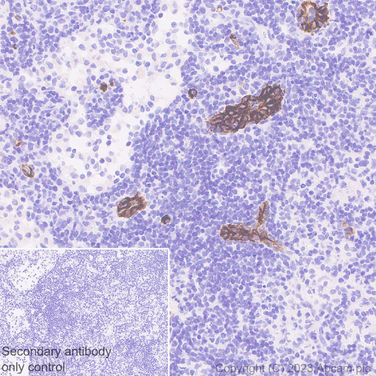 Immunohistochemistry (Formalin/PFA-fixed paraffin-embedded sections) - Anti-MAdCAM1 antibody [EPR27223-58] (AB309487)