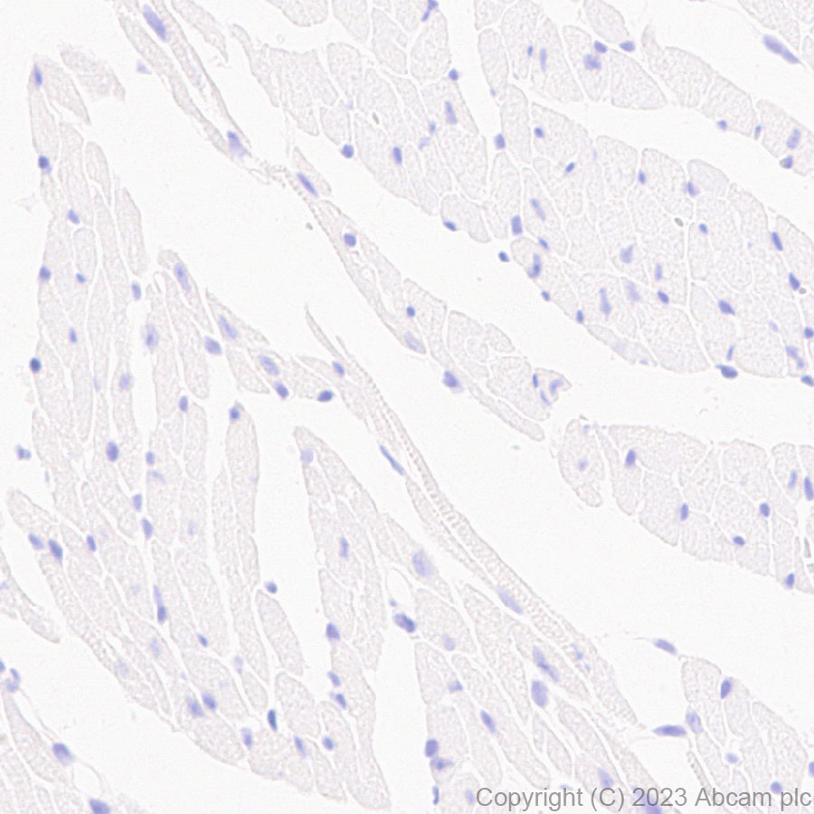 Immunohistochemistry (Formalin/PFA-fixed paraffin-embedded sections) - Anti-MAdCAM1 antibody [EPR27223-58] (ab309487), expandable thumbnail