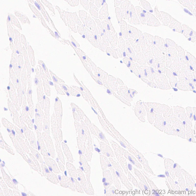 Immunohistochemistry (Formalin/PFA-fixed paraffin-embedded sections) - Anti-MAdCAM1 antibody [EPR27223-58] (AB309487)