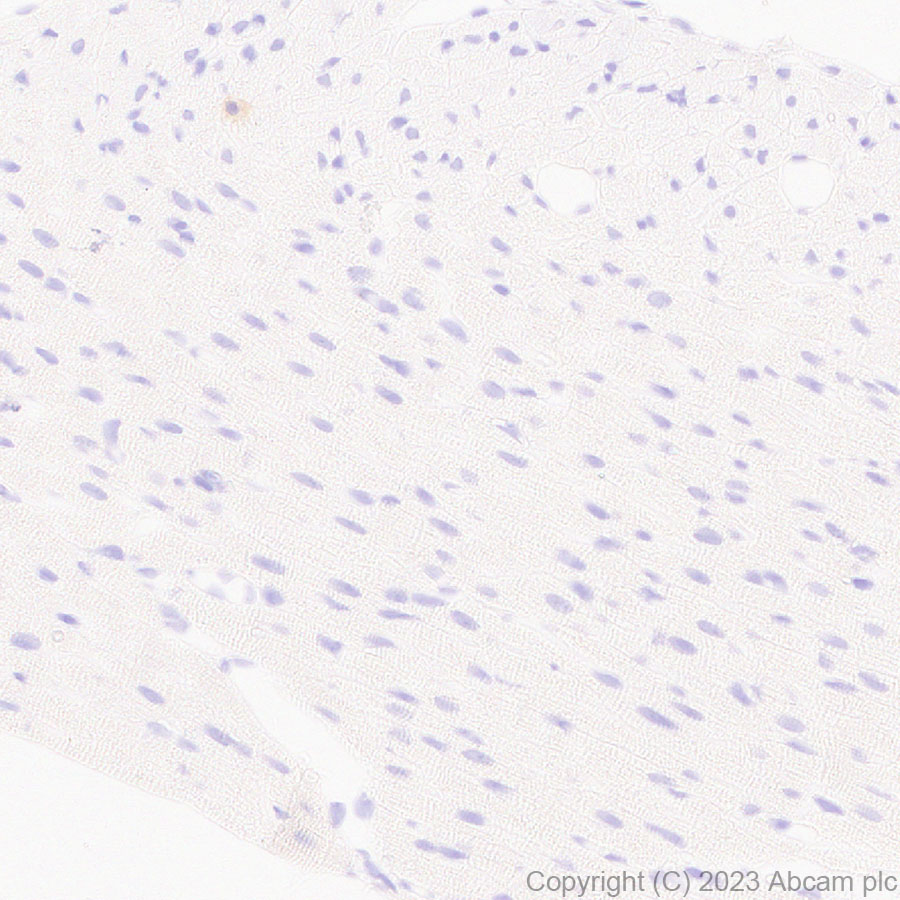 Immunohistochemistry (Formalin/PFA-fixed paraffin-embedded sections) - Anti-MAdCAM1 antibody [EPR27223-58] (AB309487), expandable thumbnail