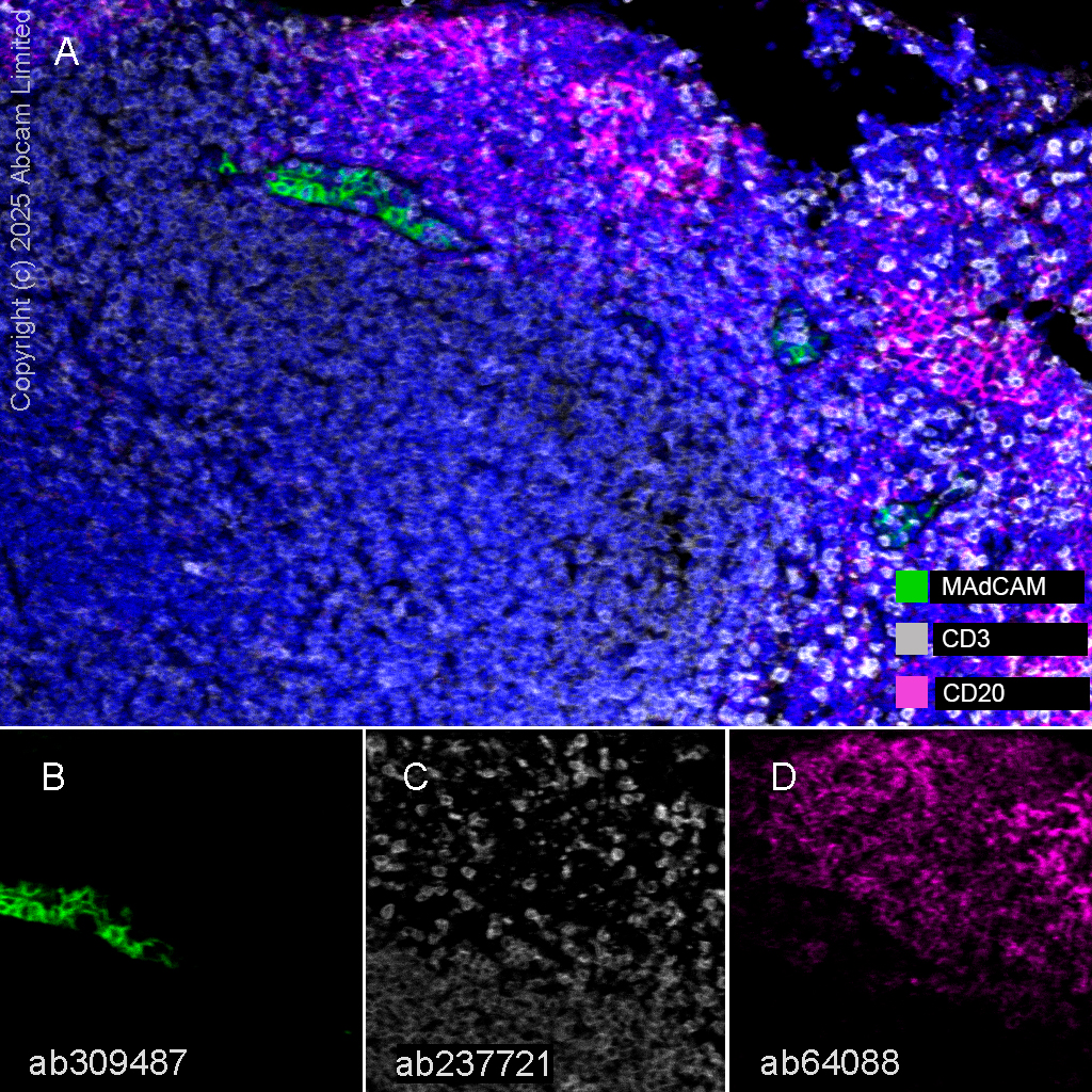 Multiplex immunohistochemistry - Anti-MAdCAM1 antibody [EPR27223-58] (AB309487), expandable thumbnail