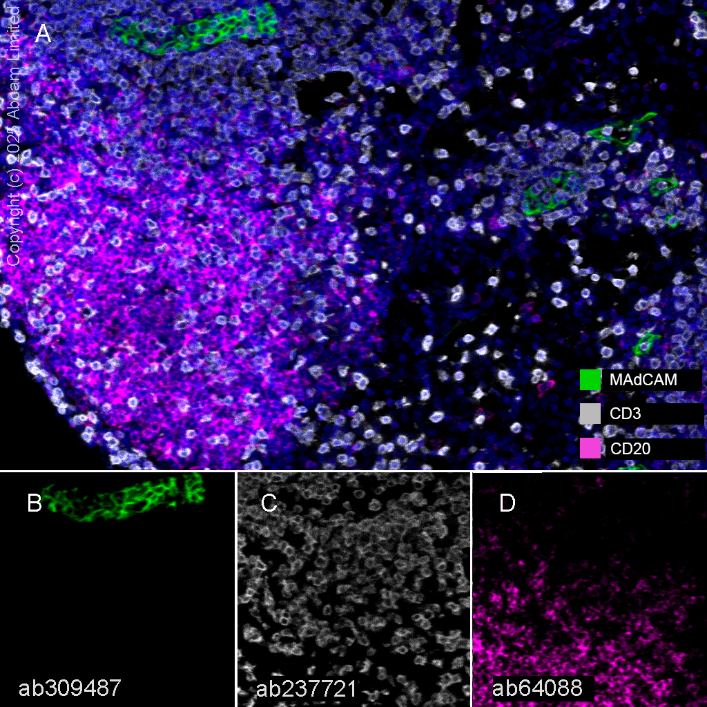 Multiplex immunohistochemistry - Anti-MAdCAM1 antibody [EPR27223-58] (AB309487), expandable thumbnail