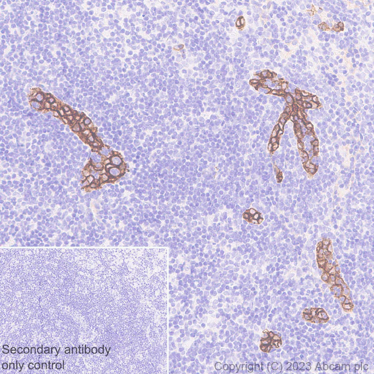 Immunohistochemistry (Formalin/PFA-fixed paraffin-embedded sections) - Anti-MAdCAM1 antibody [EPR27223-58] - BSA and Azide free (AB309488)