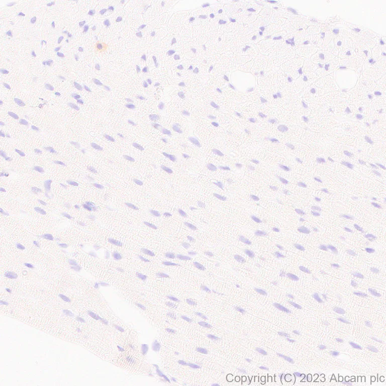 Immunohistochemistry (Formalin/PFA-fixed paraffin-embedded sections) - Anti-MAdCAM1 antibody [EPR27223-58] - BSA and Azide free (AB309488)