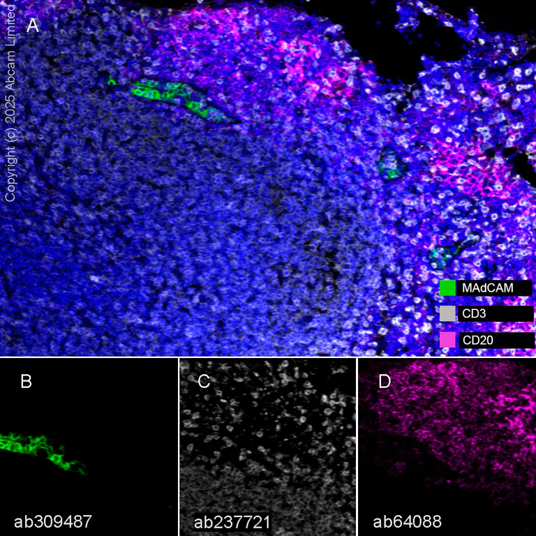 Multiplex immunohistochemistry - Anti-MAdCAM1 antibody [EPR27223-58] - BSA and Azide free (AB309488)