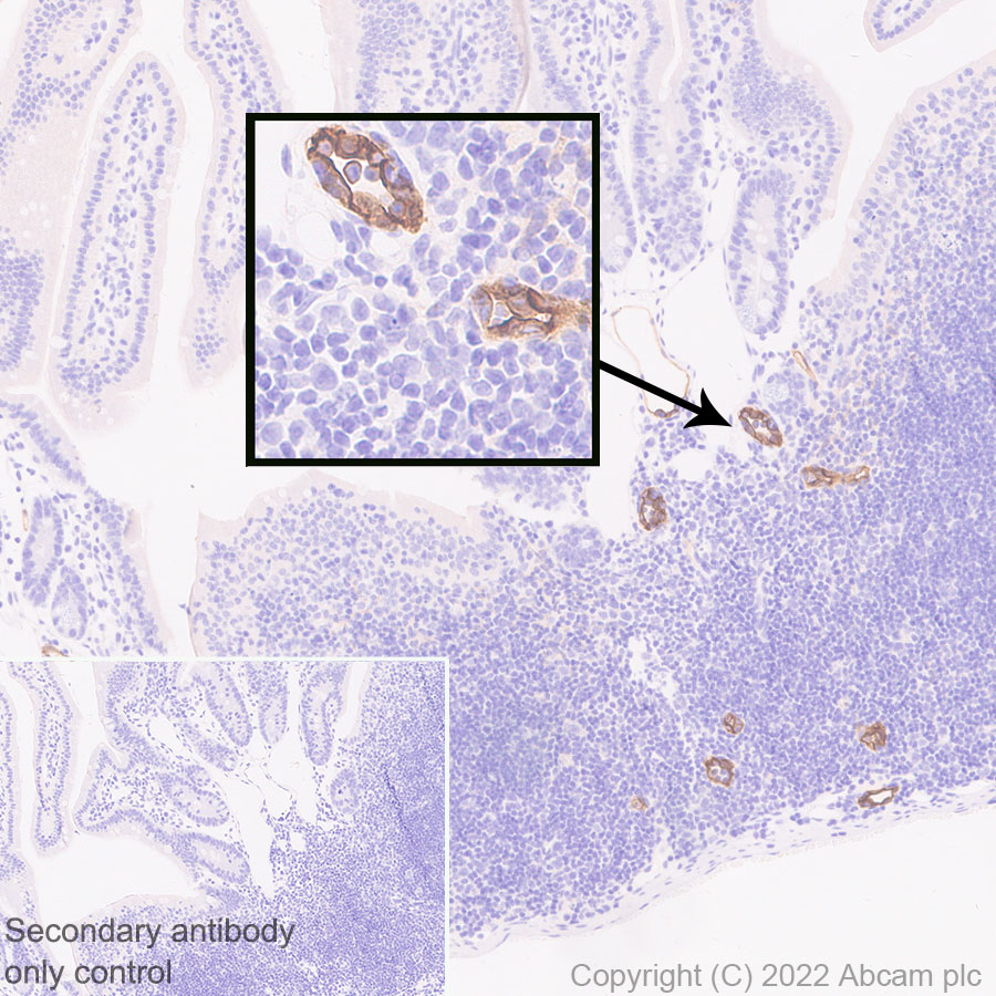 Immunohistochemistry (Formalin/PFA-fixed paraffin-embedded sections) - Anti-MAdCAM1 antibody [EPR27223-77] (AB307827), expandable thumbnail