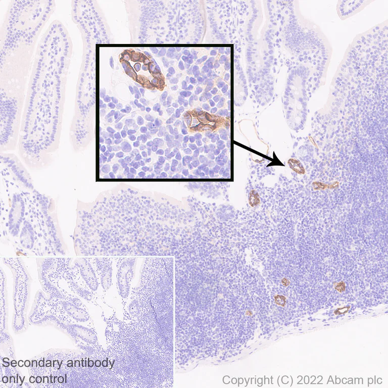 Immunohistochemistry (Formalin/PFA-fixed paraffin-embedded sections) - Anti-MAdCAM1 antibody [EPR27223-77] (AB307827)