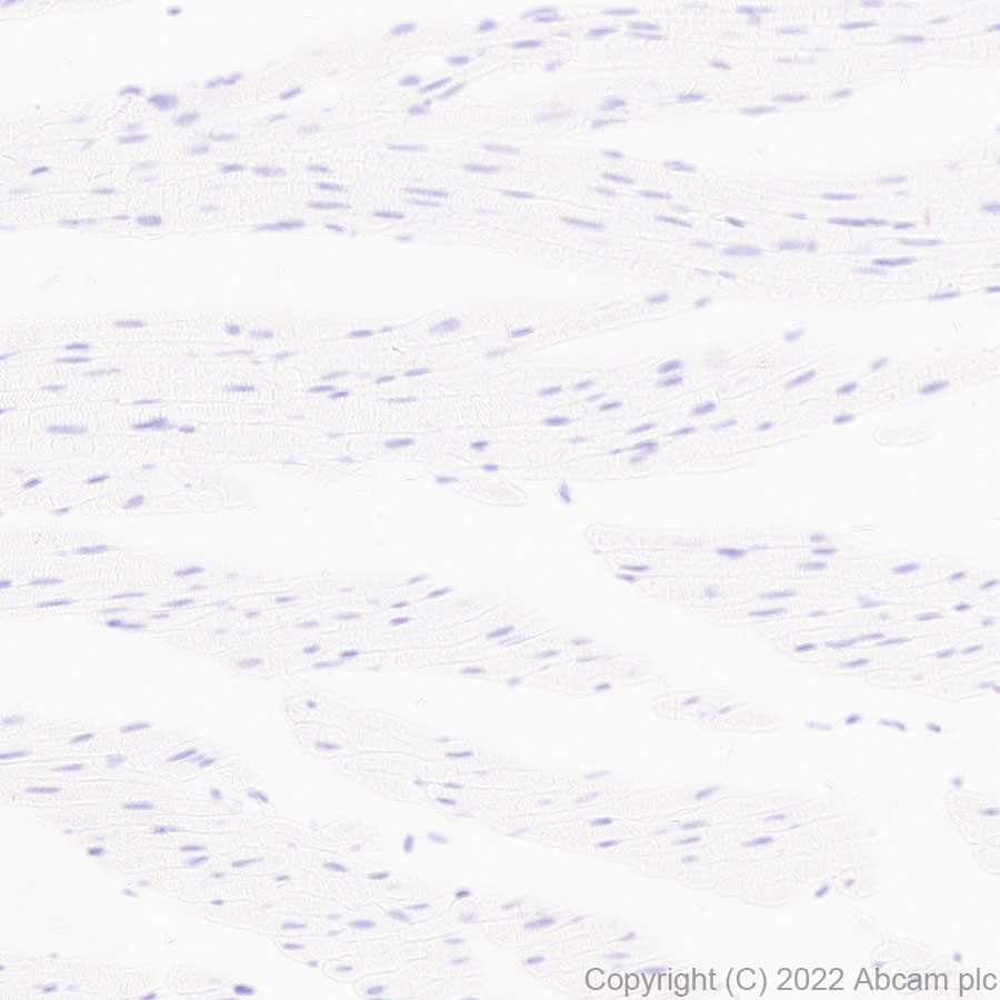 Immunohistochemistry (Formalin/PFA-fixed paraffin-embedded sections) - Anti-MAdCAM1 antibody [EPR27223-77] (AB307827), expandable thumbnail