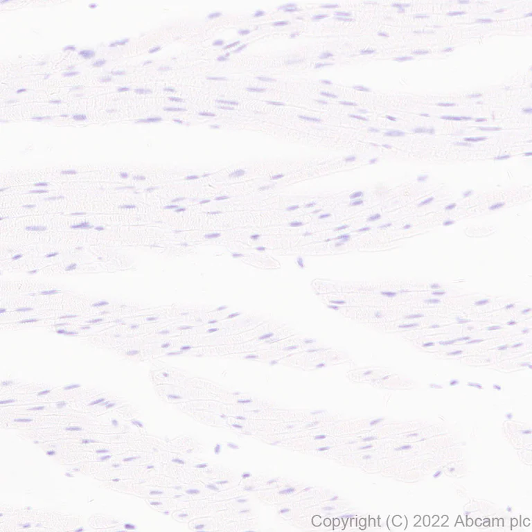 Immunohistochemistry (Formalin/PFA-fixed paraffin-embedded sections) - Anti-MAdCAM1 antibody [EPR27223-77] (AB307827)