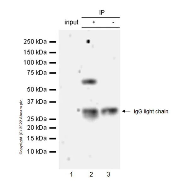Immunoprecipitation - Anti-MAdCAM1 antibody [EPR27223-77] (AB307827)