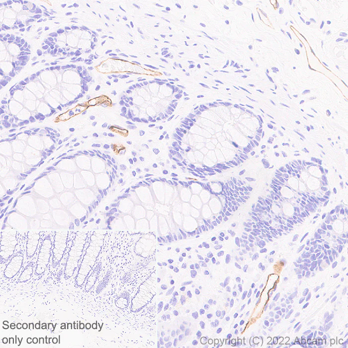 Immunohistochemistry (Formalin/PFA-fixed paraffin-embedded sections) - Anti-MAdCAM1 antibody [EPR27555-87] (AB307734)
