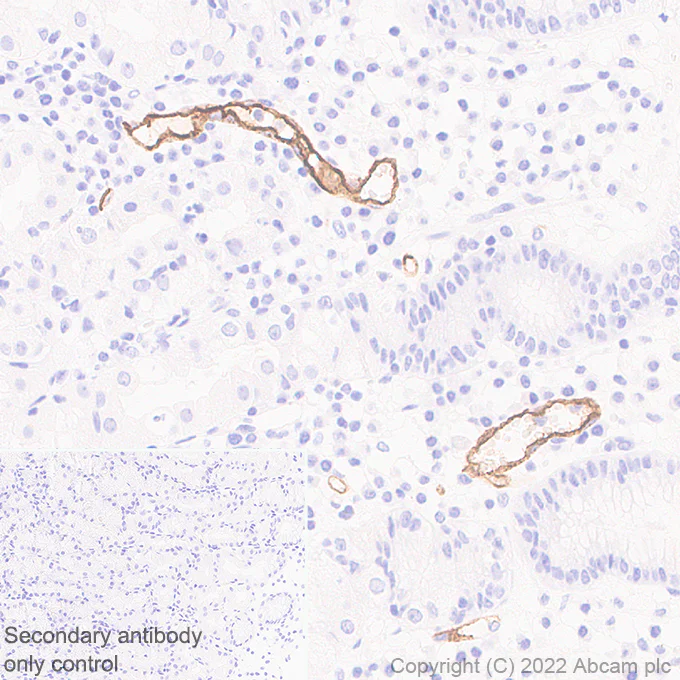Immunohistochemistry (Formalin/PFA-fixed paraffin-embedded sections) - Anti-MAdCAM1 antibody [EPR27555-87] (AB307734)