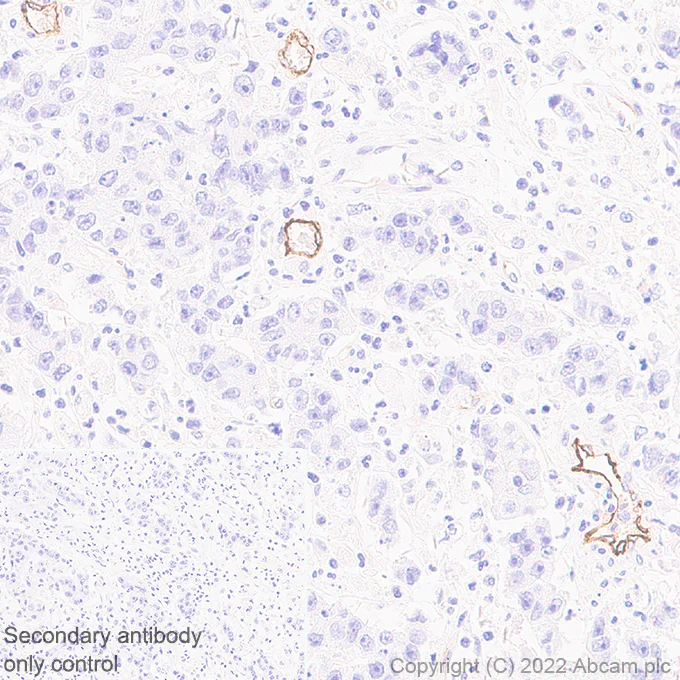 Immunohistochemistry (Formalin/PFA-fixed paraffin-embedded sections) - Anti-MAdCAM1 antibody [EPR27555-87] (AB307734)