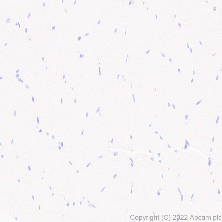 Immunohistochemistry (Formalin/PFA-fixed paraffin-embedded sections) - Anti-MAdCAM1 antibody [EPR27555-87] (AB307734)