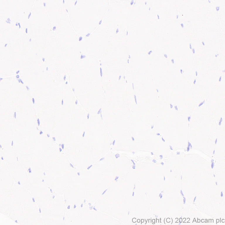 Immunohistochemistry (Formalin/PFA-fixed paraffin-embedded sections) - Anti-MAdCAM1 antibody [EPR27555-87] (AB307734)