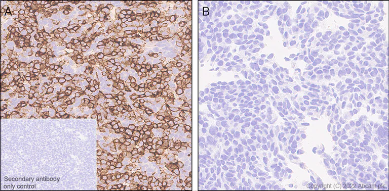 Anti-MAdCAM1 antibody [EPR27555-87] (ab307734) | Abcam