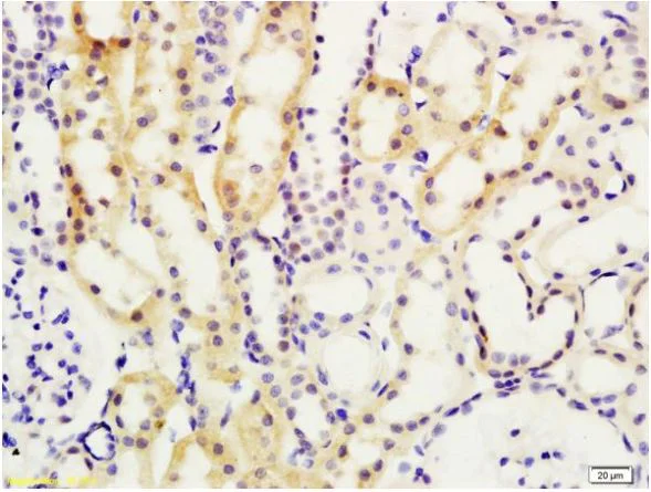 Immunohistochemistry (Formalin/PFA-fixed paraffin-embedded sections) - Anti-MADH7/SMAD7 antibody (AB216428)