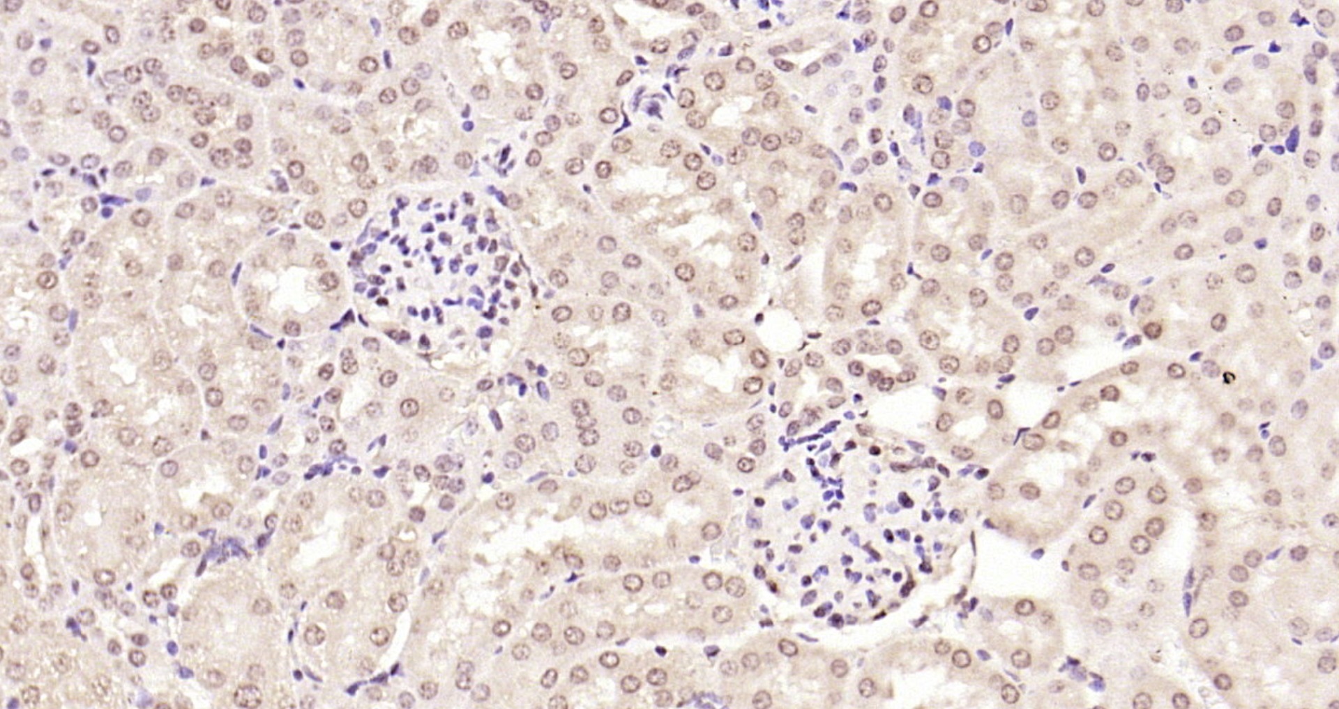 madh7-smad7-antibody-ab216428-