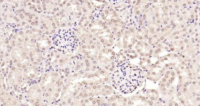 Immunohistochemistry (Formalin/PFA-fixed paraffin-embedded sections) - Anti-MADH7/SMAD7 antibody (AB216428)