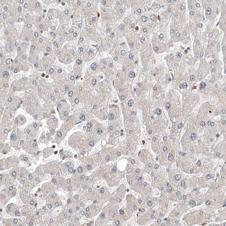 Immunohistochemistry (Formalin/PFA-fixed paraffin-embedded sections) - Anti-MADH7/SMAD7 antibody (AB244424)
