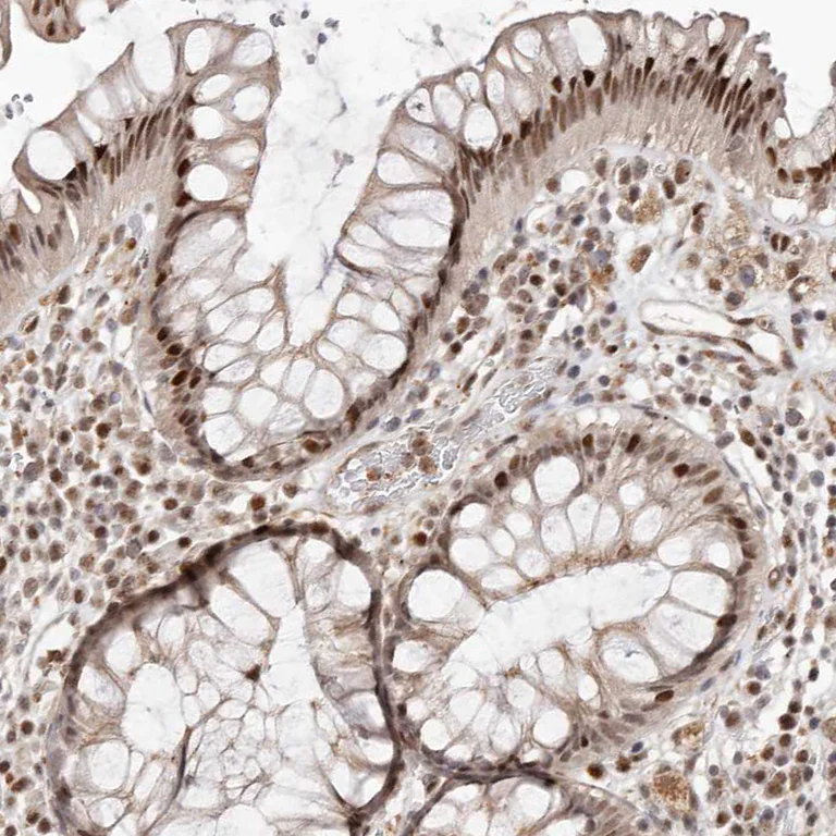 Immunohistochemistry (Formalin/PFA-fixed paraffin-embedded sections) - Anti-MADH7/SMAD7 antibody (AB244424)