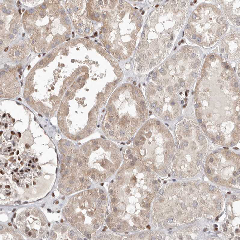 Immunohistochemistry (Formalin/PFA-fixed paraffin-embedded sections) - Anti-MADH7/SMAD7 antibody (AB244424)
