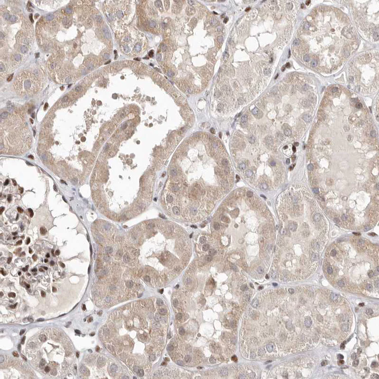 Immunohistochemistry (Formalin/PFA-fixed paraffin-embedded sections) - Anti-MADH7/SMAD7 antibody (AB244424)