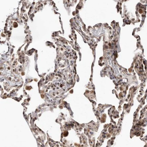 Immunohistochemistry (Formalin/PFA-fixed paraffin-embedded sections) - Anti-MADH7/SMAD7 antibody (AB244424)